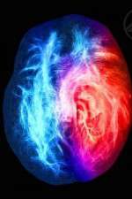 Watch Brain on Fire Putlocker