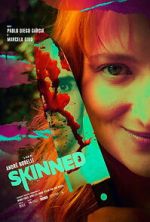 Watch Skinned Putlocker