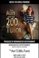 Watch The Man With The 200lb Tumor Putlocker