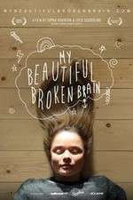 Watch My Beautiful Broken Brain Putlocker